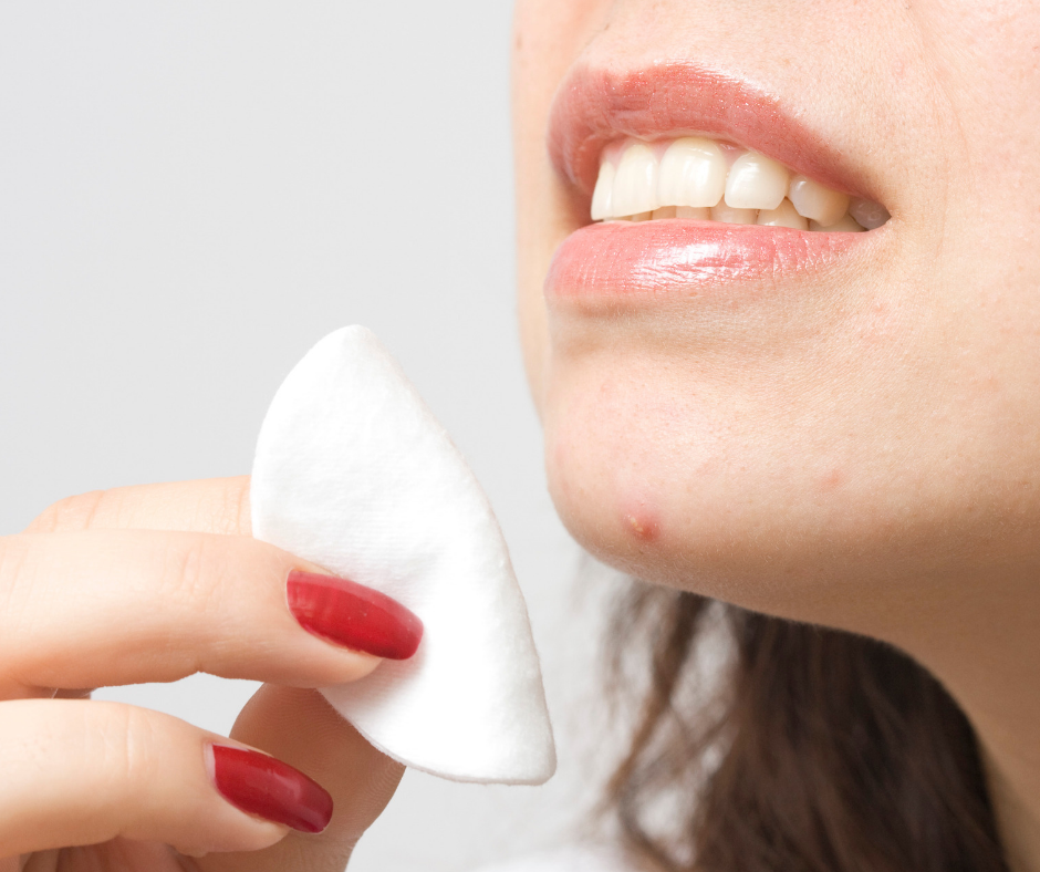 How to Fight Acne Naturally - Of Course